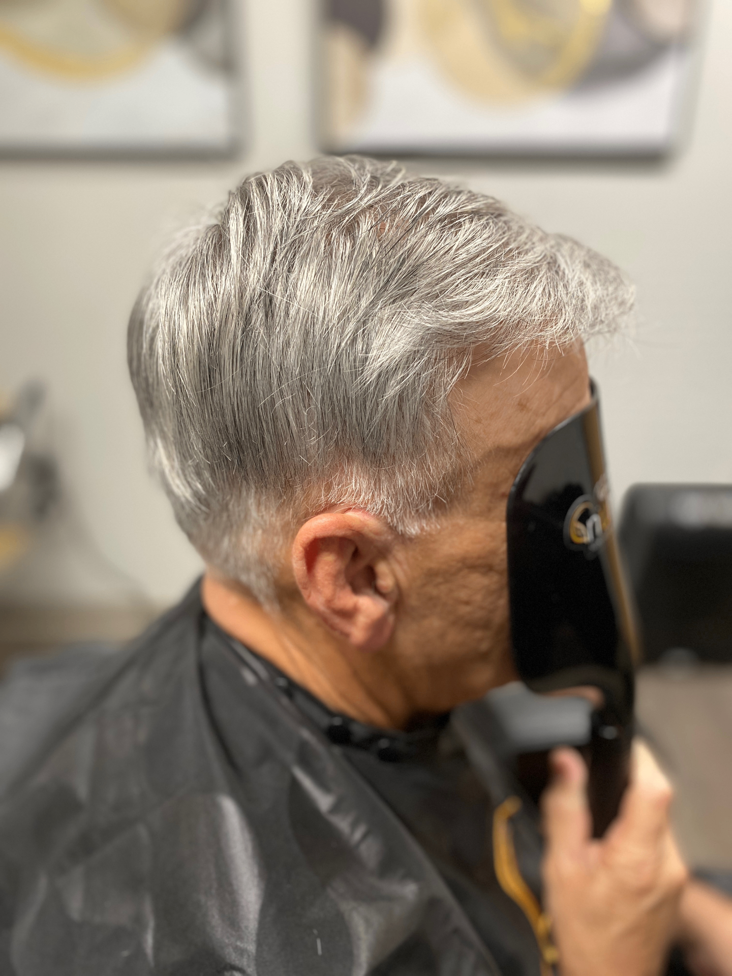 After hair restoration 4