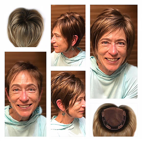 A collage of various stages of a woman's hair restoration process. Going from thinning hair to a fuller, more beautiful looking head of hair.